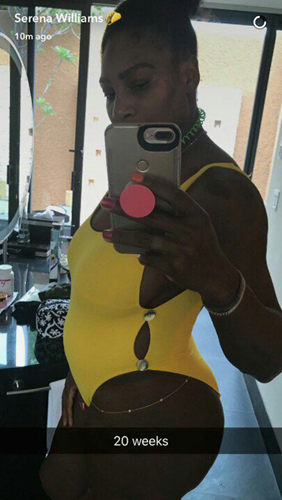 Serena Williams babát vár