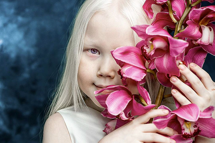 Sikeres modell lett az albínó kislányból