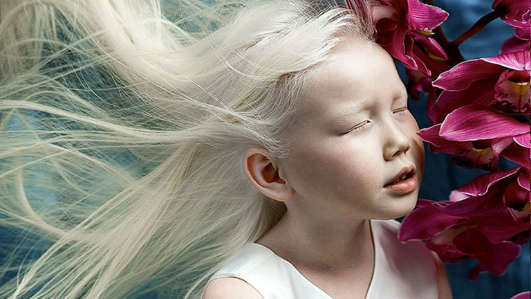 Sikeres modell lett az albínó kislányból