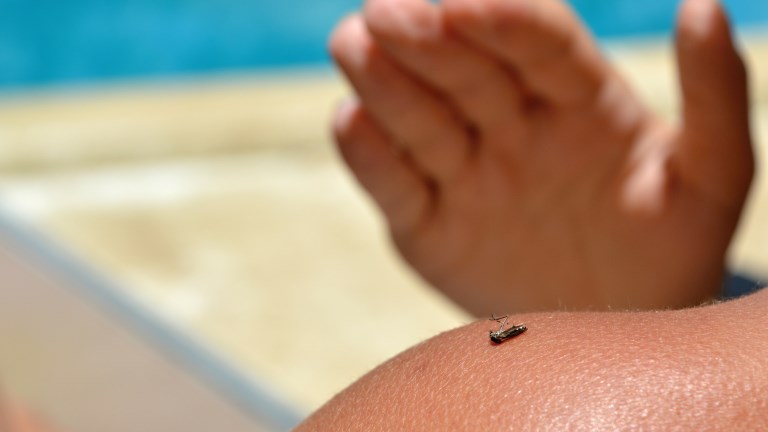 10 házi praktika, ami azonnali enyhülést hoz a szúnyogcsípésre