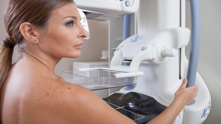 Mi történik a mammográfián?