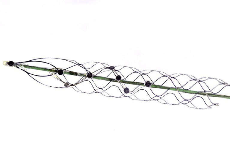 Az elektródaháló, vagyis a stent és az electrode szavakból összeállt stentrode (Fotó: University of Melbourne)
