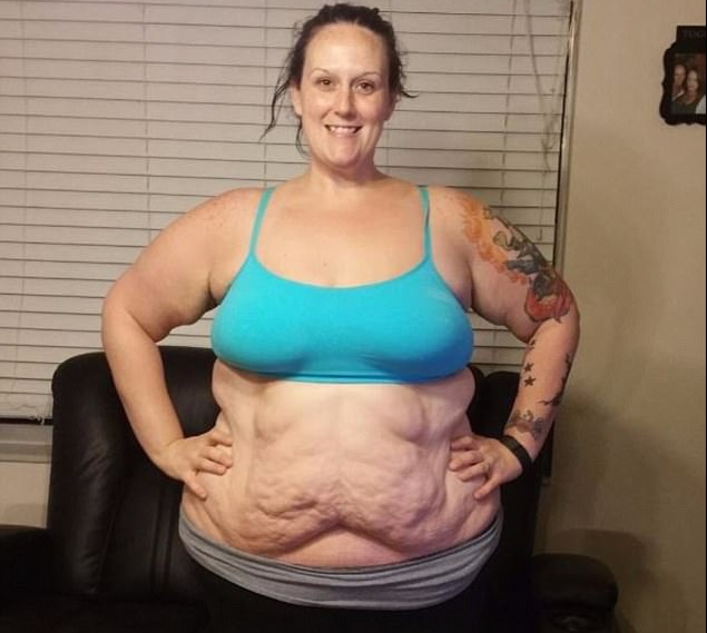 Egy év alatt 70 kilót fogyott a gyorsétterem-függő nő