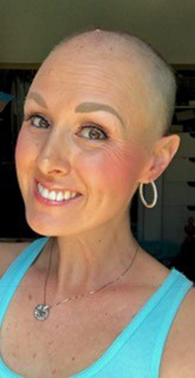 Vadidegenek hajából lett parókája a rákbeteg lánynak