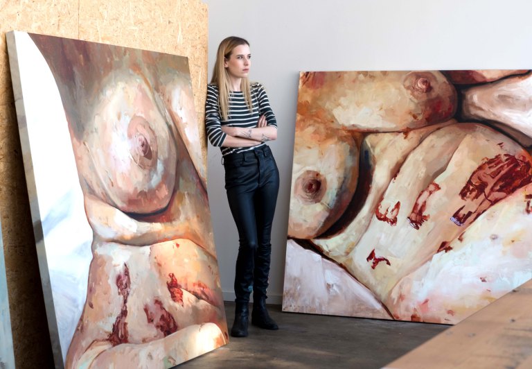 Így néz ki az endometriózis húsbavágó festményeken