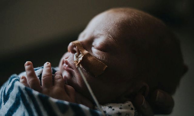 Egy anya csodálatos képei koraszülött babája küzdelméről
