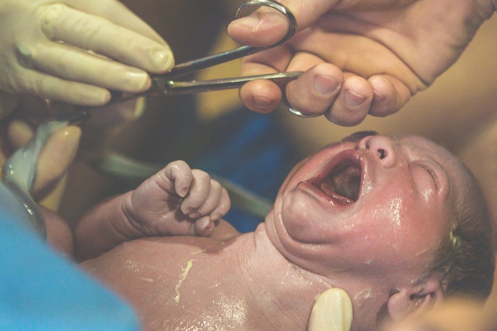 Fájdalmasan gyönyörű fotók egy szivárványbaba születéséről