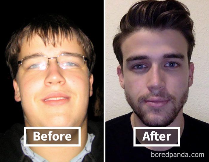 arc fogyás előtt és után