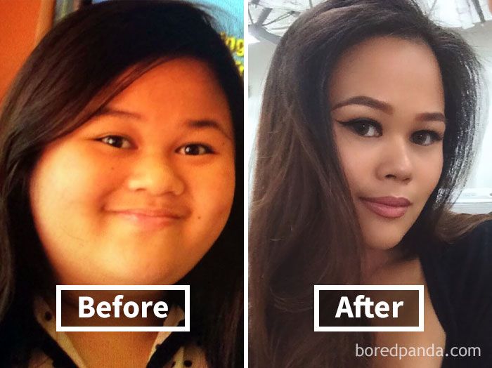 Ilyen az arc 50 kiló fogyás után: megdöbbentőek az előtte-utána képek - Fogyókúra | Femina