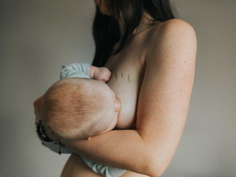 szülés utáni testkép fotósorozat