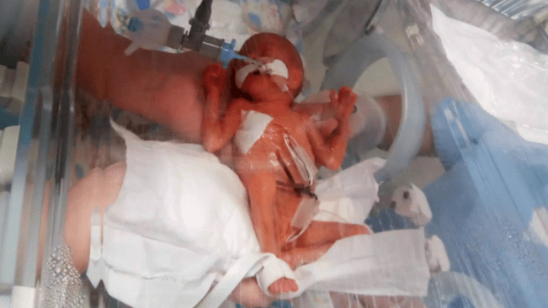 koraszülött baba kórház orvosi csoda