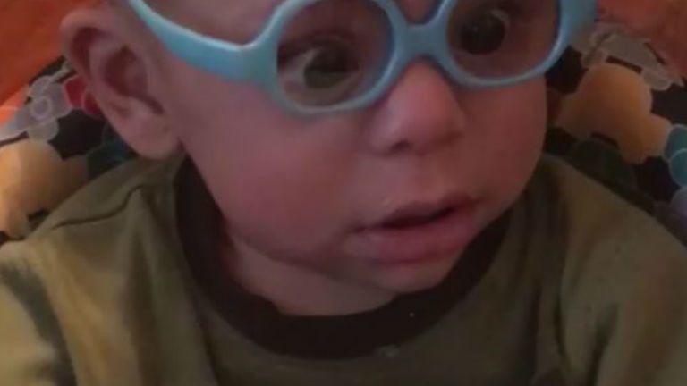 szemüveg gyerek kisbaba látás szem
