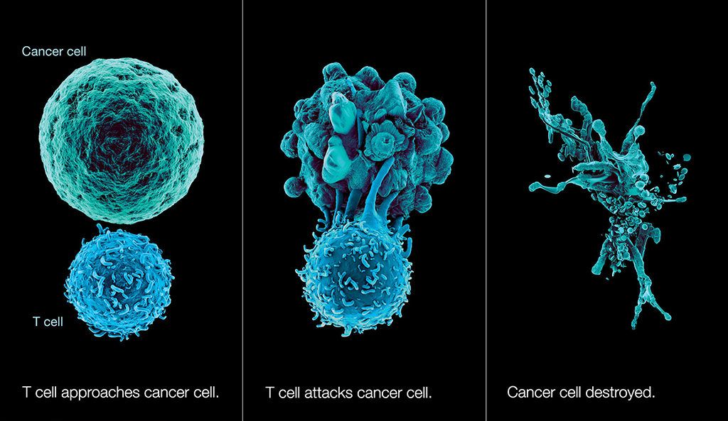 Immunotherapy immunterápia daganat rák
