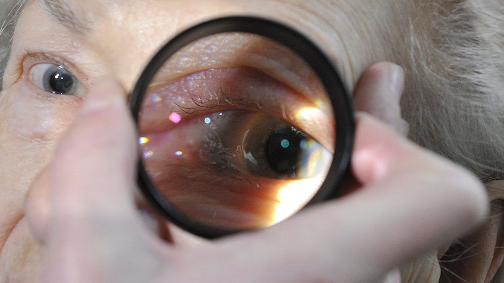 a szem oldalirányú látása