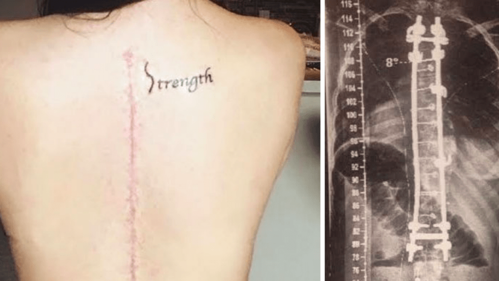 tetoválás heg bátorság