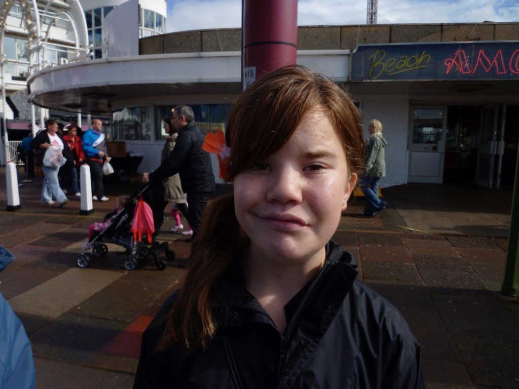 Ijesztő tünetek: a 20 éves brit Lucy Hawkinst alig három hónaposan diagnosztizálták arcbénulással (Fotó: Profimedia, Media Drum World)
