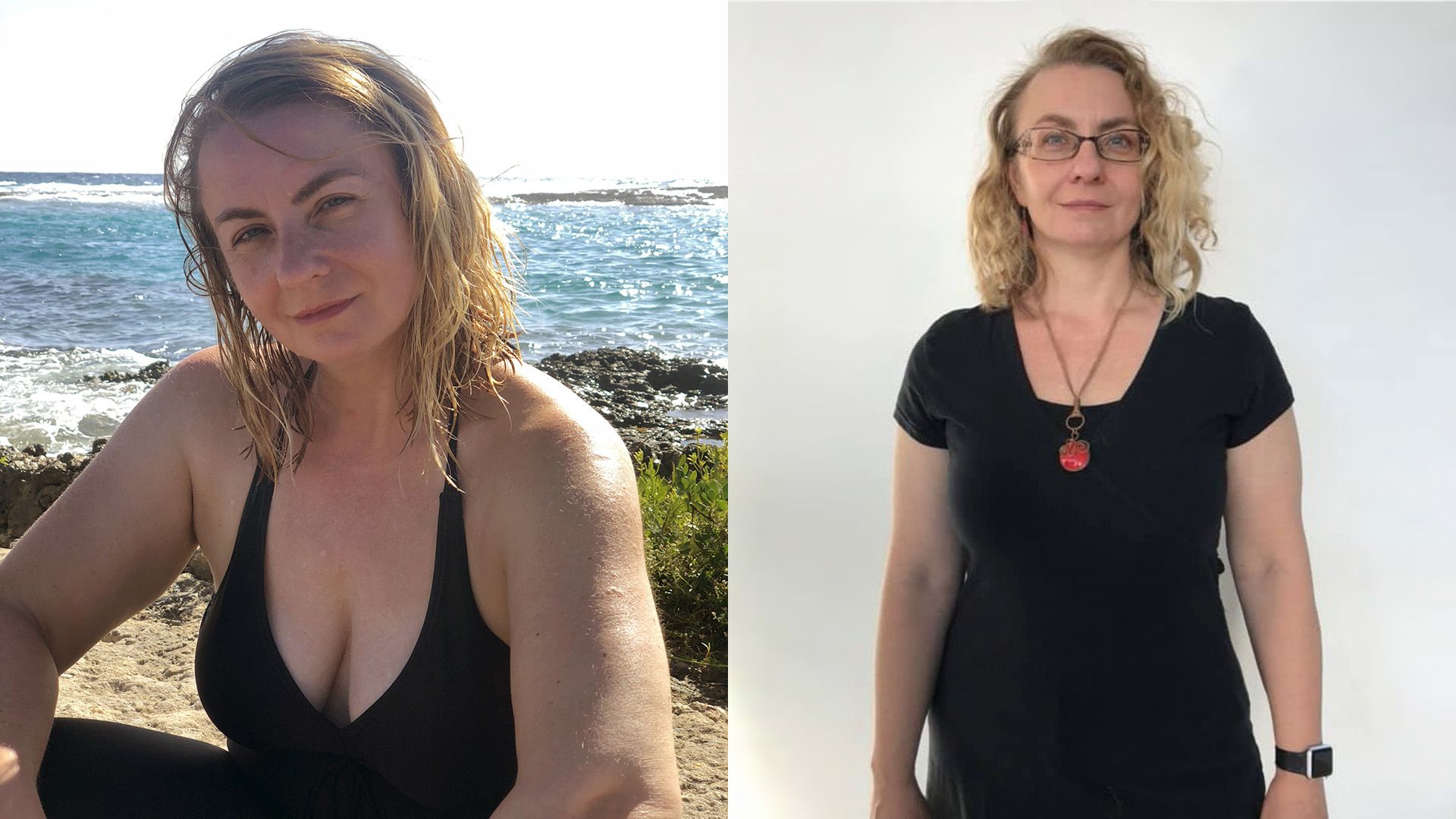 kilót fogyott műtét nélkül a 30 éves nő: képeken az átváltozása - Fogyókúra | Femina