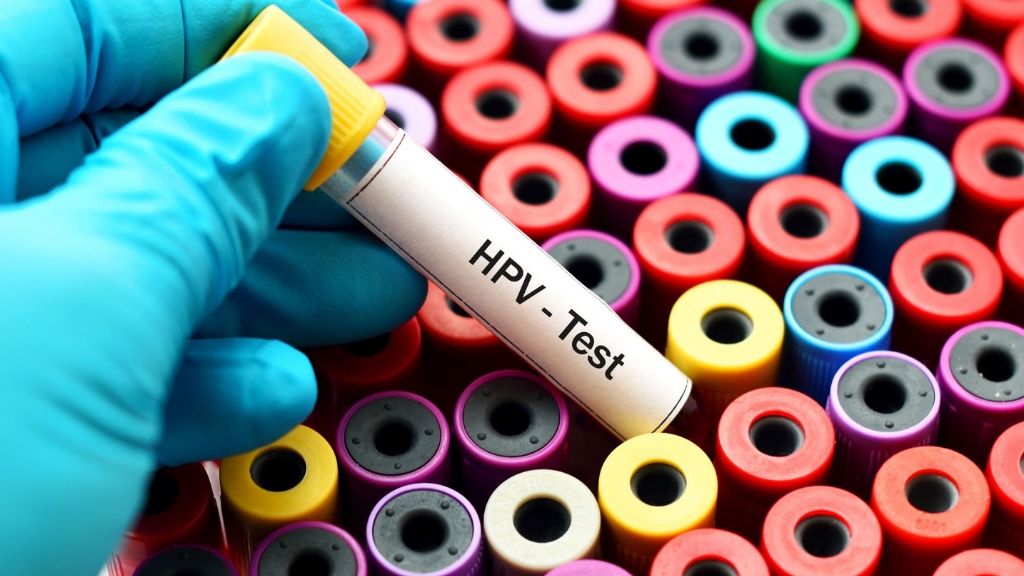 Vigyázat, daganatot okoz! - A HPV | BENU Gyógyszertárak