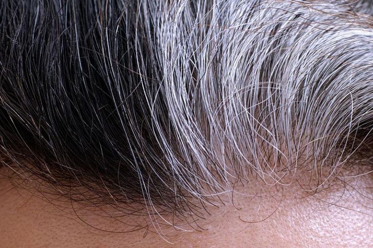 Miért titkolják a fodrászok ezt a megoldást az ősz haj ellen? (x)