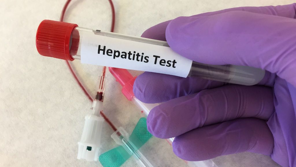 hepatitis-c szűrés
