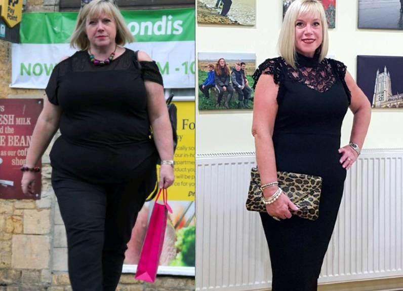 Elképesztő átalakulások: mi történik azokkal, akik ötvennél is több kilót fogynak?