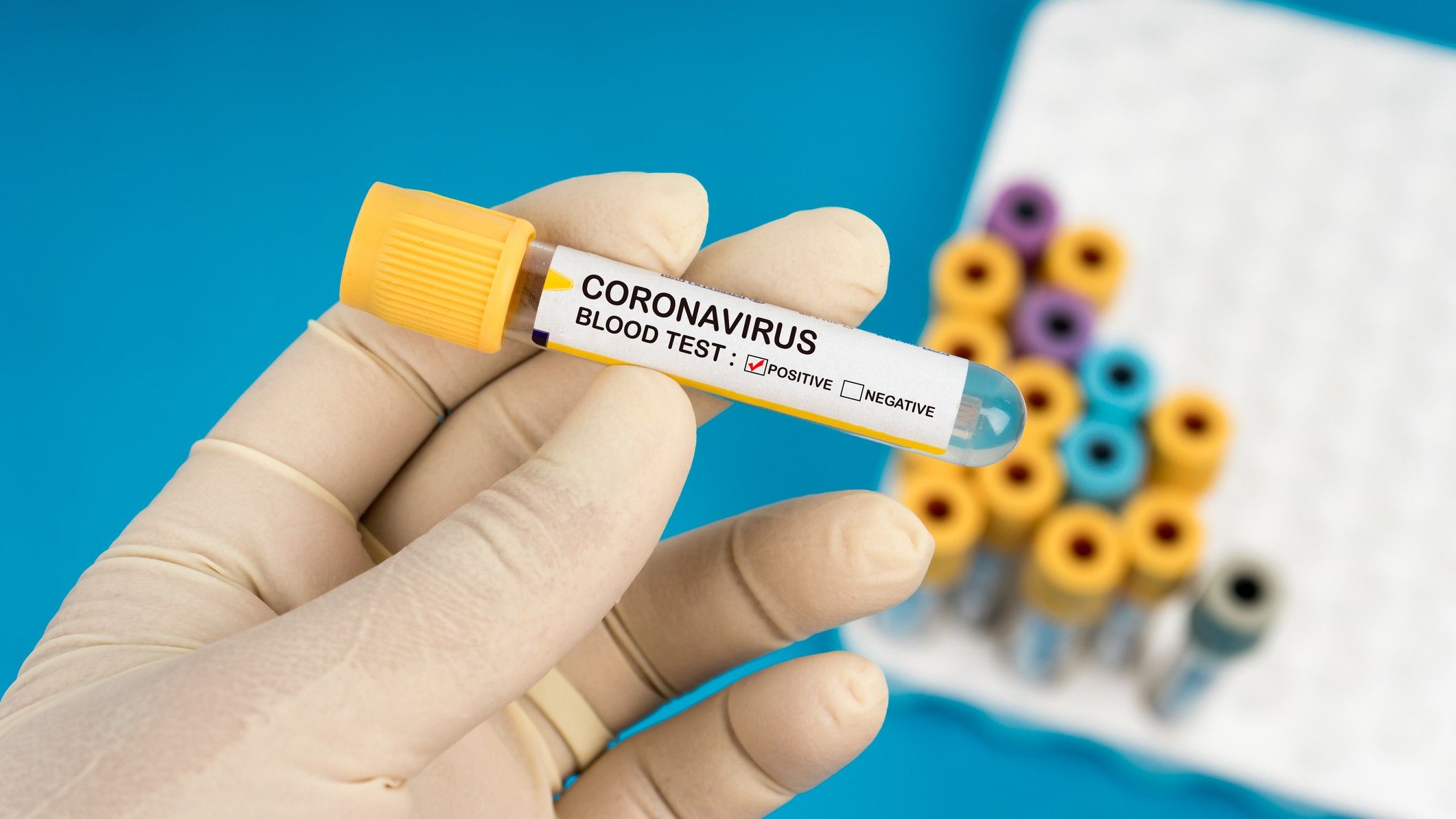 koronavírus teszt