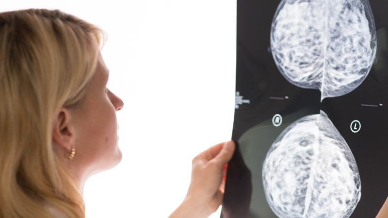 Mammográfia. Rákos? Nem rákos? (Fotó: Getty Images)