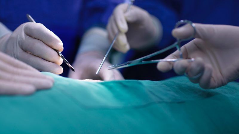 Egyes műtétekre kilencszer annyit kell várni, mint a járvány előtt