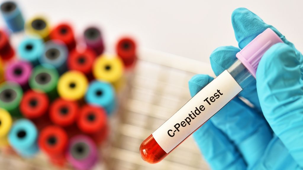C-peptid | Lab Tests Online-HU