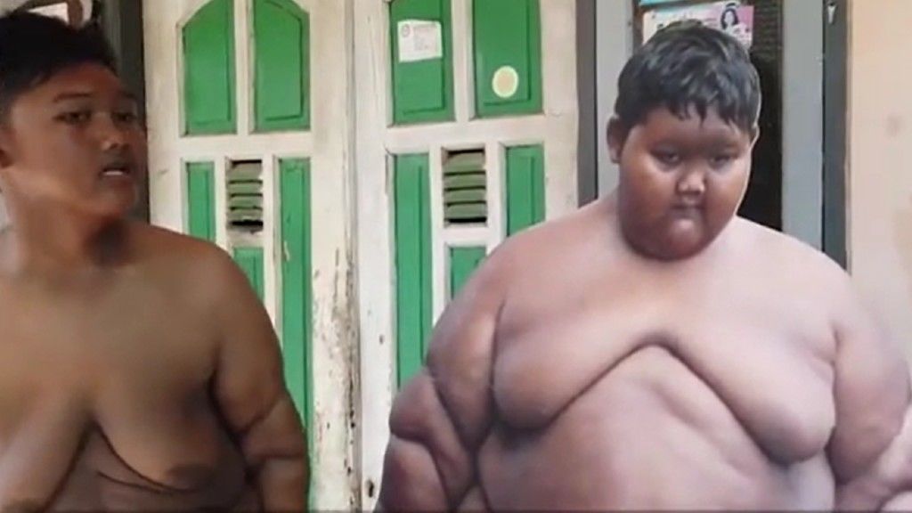 Híres focista szeretne lenni a fiú, aki korábban Indonézia legkövérebb gyereke volt | nlc
