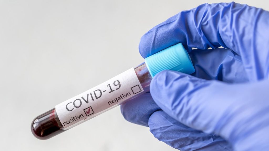 Koronavírus teszt