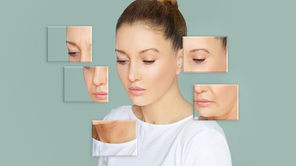 Hialuronsavas feltöltés az arc több területén alkalmazható az öregedés jeleinek korrigálására.