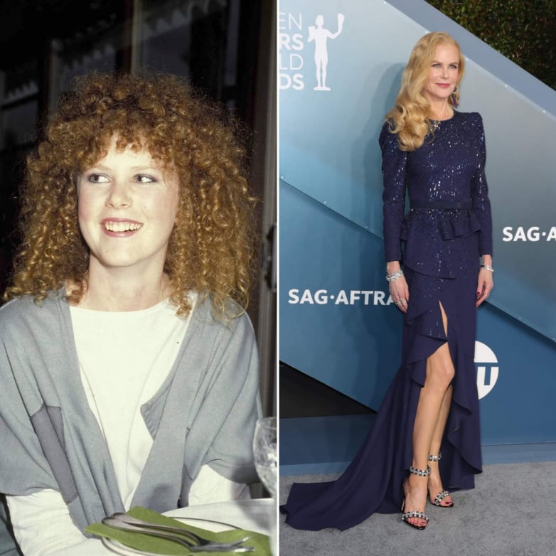 Nicole Kidman akkor és most