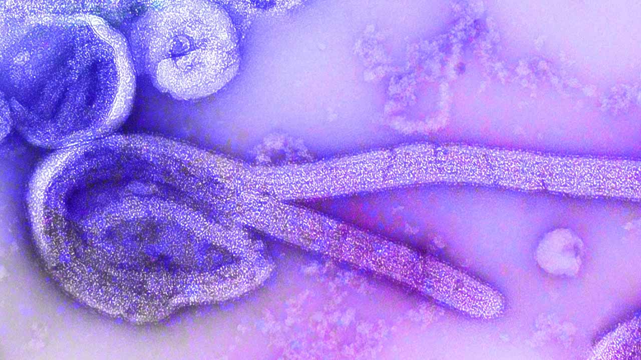 Az ebolavírus mikroszkóp alatt / Fotó: Unsplash
