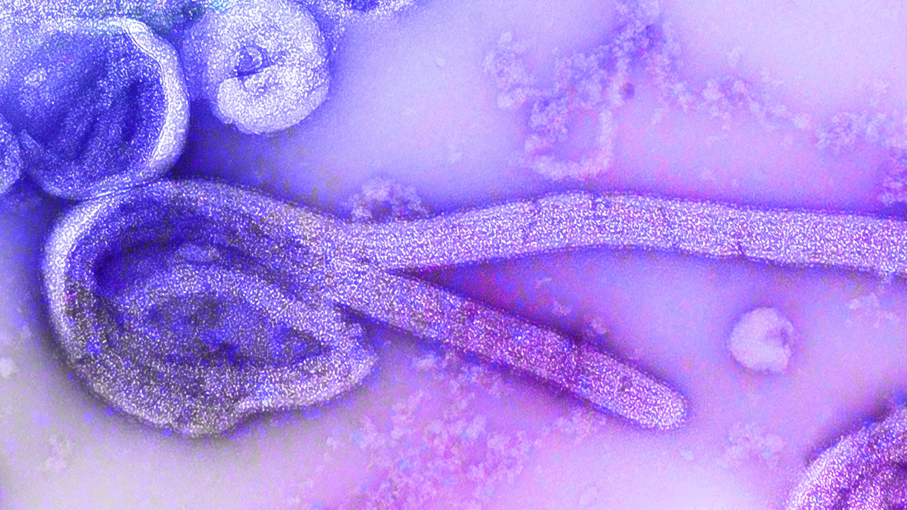 Az ebola vírus / Fotó: Unsplash