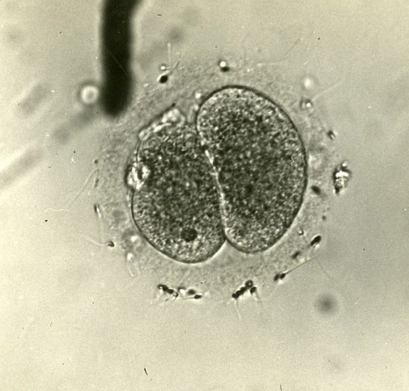 Menkin a világon elsőként láthatott üvegben megtermékenyített emberi embriót (Fotó: BBC)