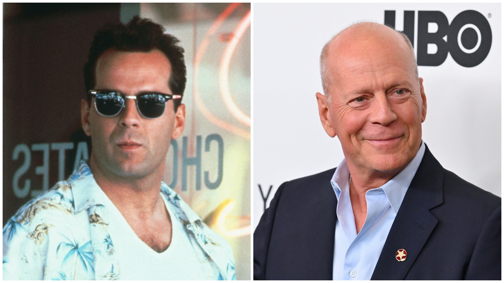 Bruce Willis hajjal és kopaszon