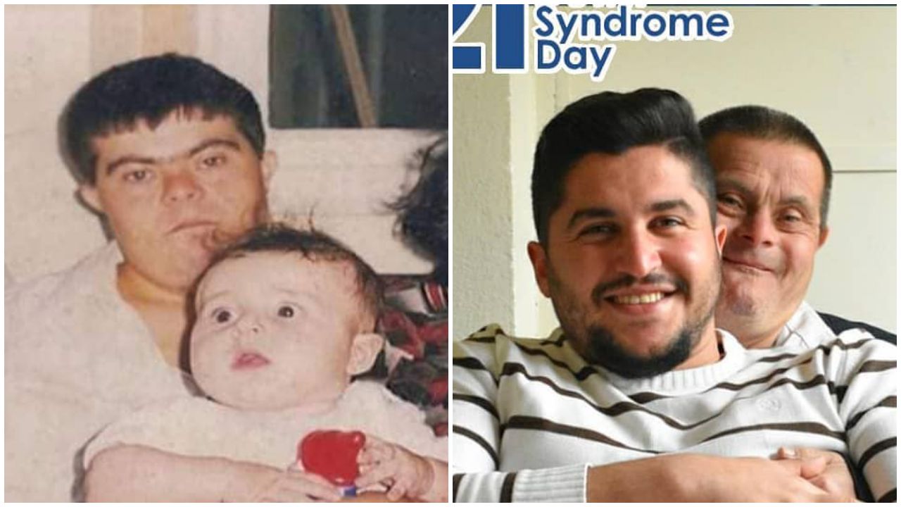 Down-szindrómás apa és fia 22 év különbséggel