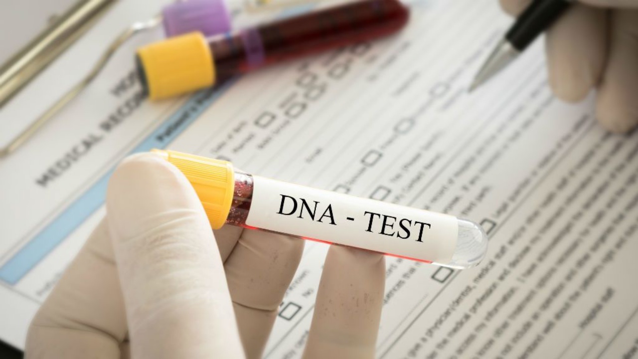 DNS-teszt