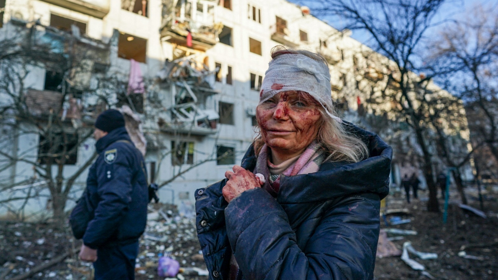 Az orosz rakétatámadásban megsebesült Olena Kurilo a lebombázott otthona előtt Csuhuivben