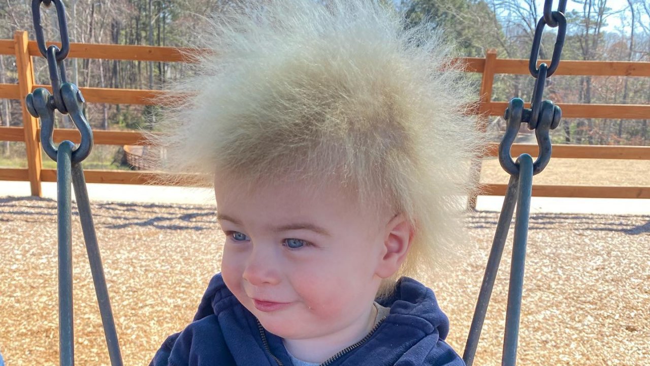 A fésületlen haj szindróma miatt kócos kisfiú