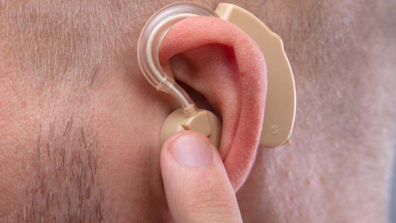 hallásjavító fülimplantátum