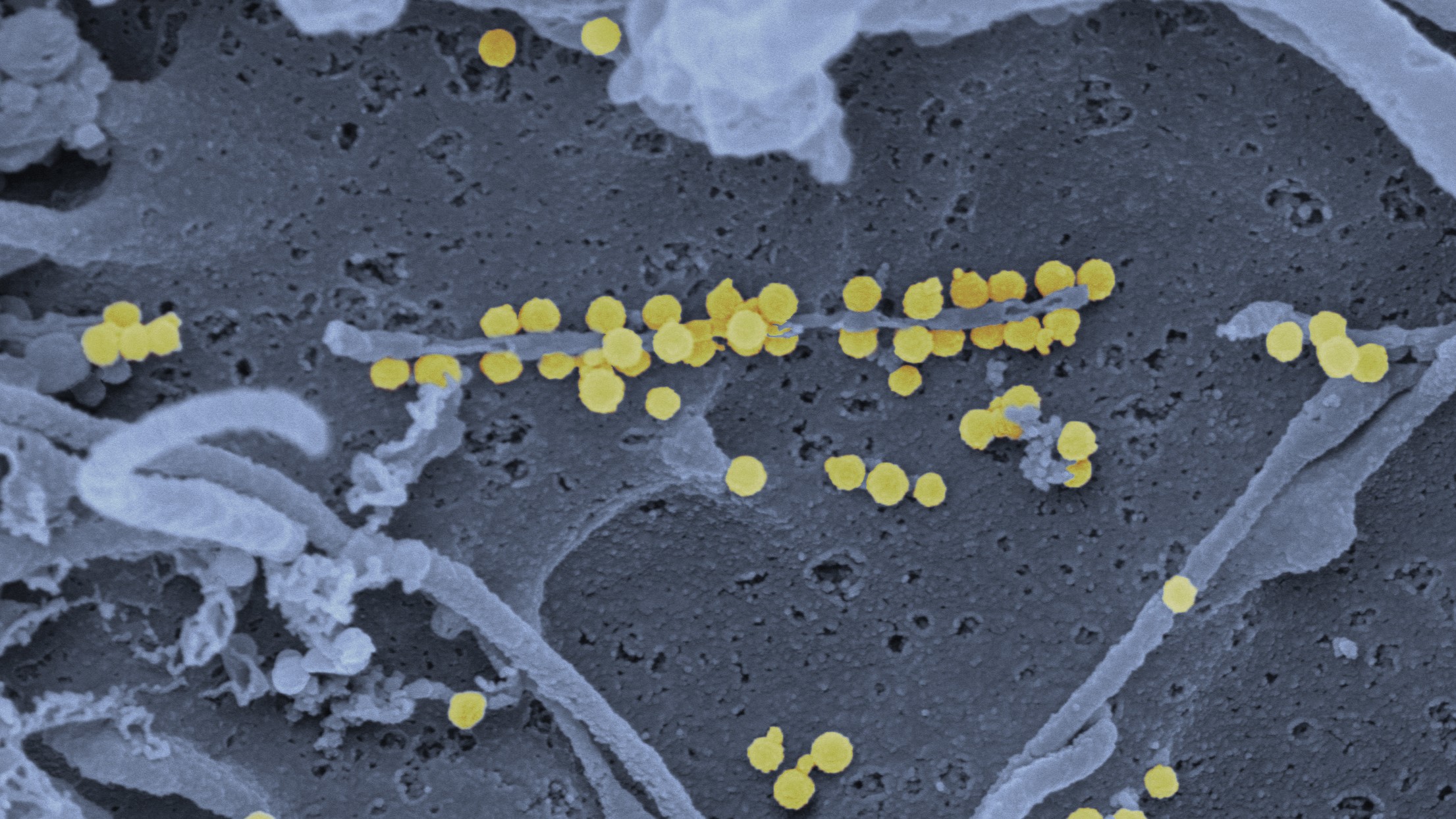 A sárga pöttyök jelentik a vírus jelenlétét (Fotó: Wikipedia)