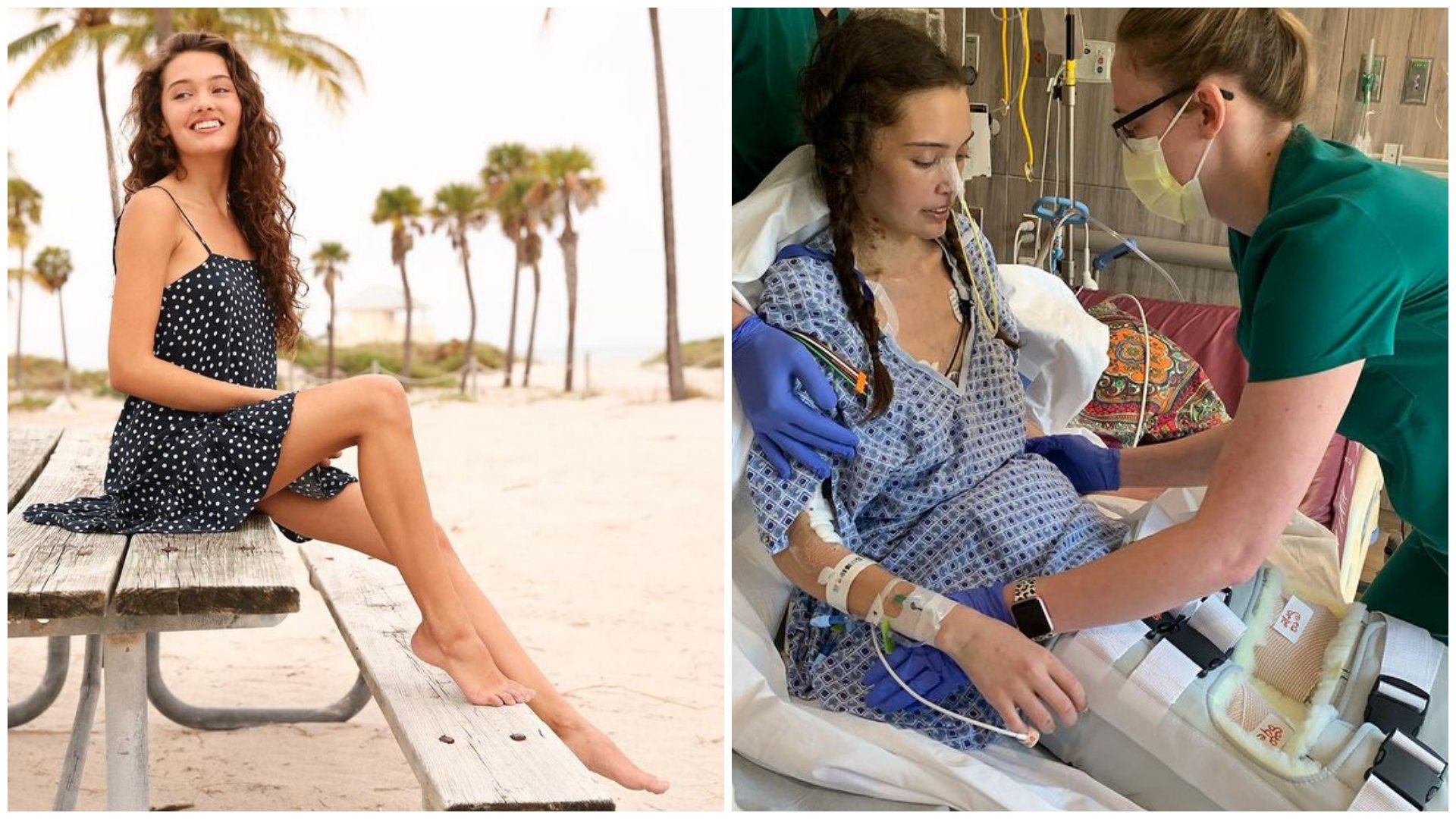 Claire Bridges modell az amputálás előtt és utána
