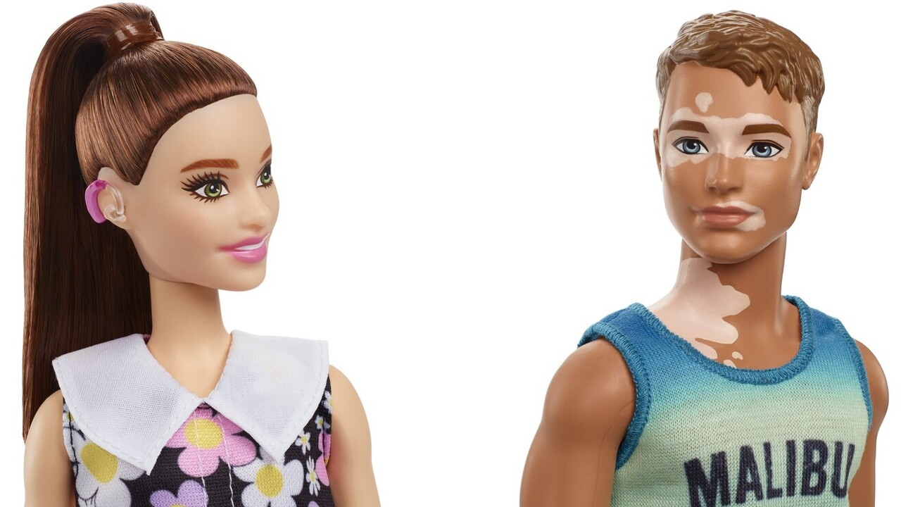 Hallássérült Barbie és vitiligós Ken