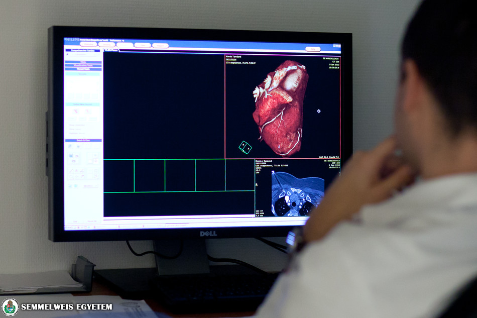 szív- és érrendszeri megbetegedések kutatás ikervizsgálat ikrek Semmelweis Egyetem