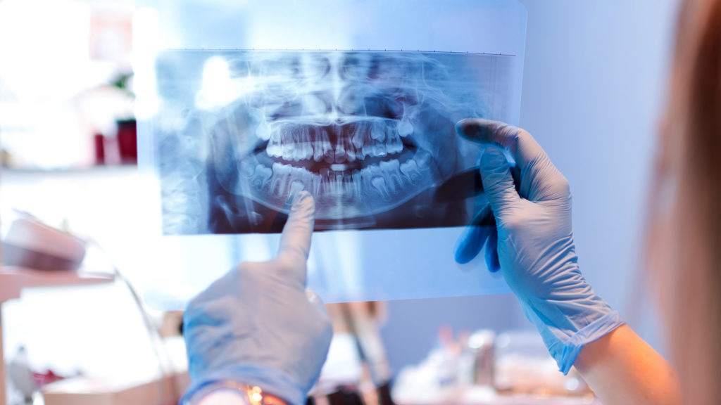 fogorvos páciens fogtömés foghúzás