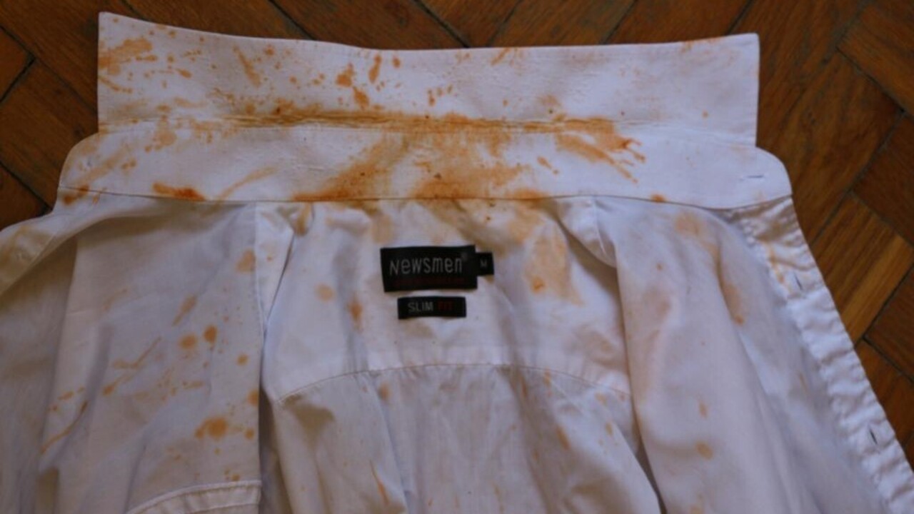Így nézett ki a pincér inge a támadás után (Fotó: police.hu)