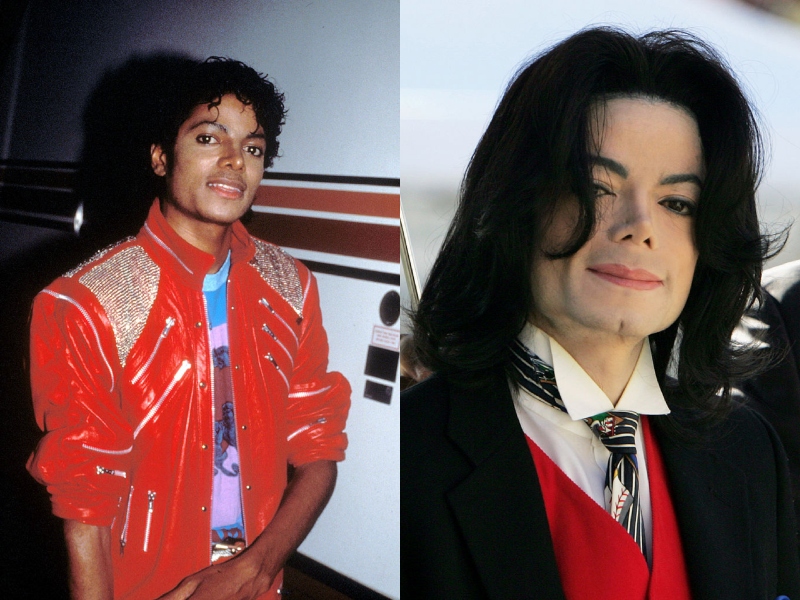 Előtte-utána fotó: Michael Jackson