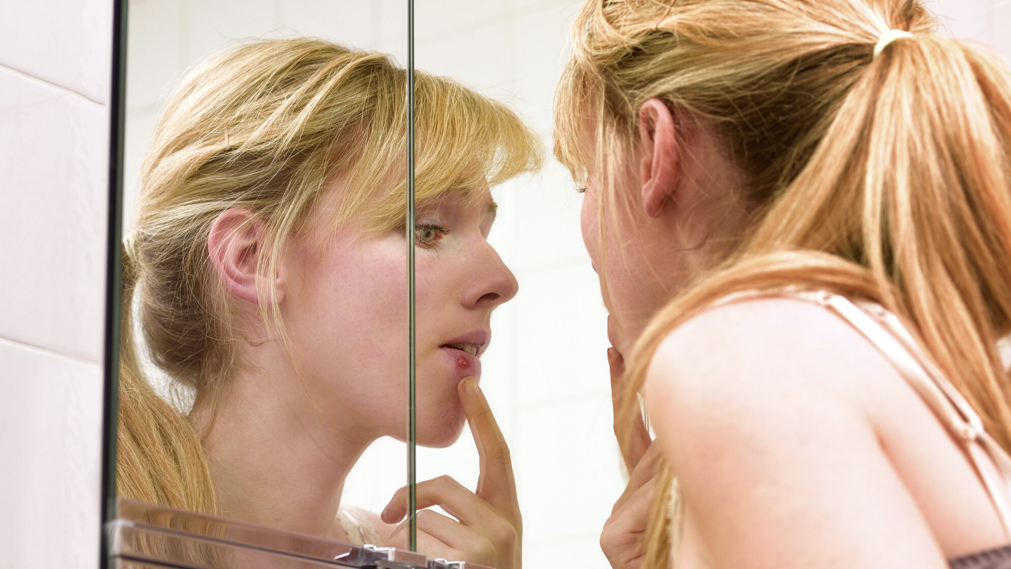 Egy fiatal nő áll a fürdőszobában a tükör előtt, és vizsgálja az ajkán lévő herpeszt.